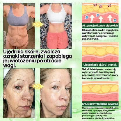 🔥🔥 𝐆𝐞𝑒𝐿𝑒𝐦𝐨𝐧® 𝐆𝐥𝐮𝐦ase𝐭𝐢𝐝𝐞 𝟖 𝐰 𝟏 Smukły i Zdrowy Nano Plaster z Mikronakłuciami 🇵🇱(Tylko raz dziennie, widoczne zmiany już w 7 dni)✅ Na otyłość, 🅛🅞🅞🅢🅔 🅢🅚🅘🅝 wiotką skórę, cukrzycę, bezdech senny, problemy ze stawami i wiele więcej 5