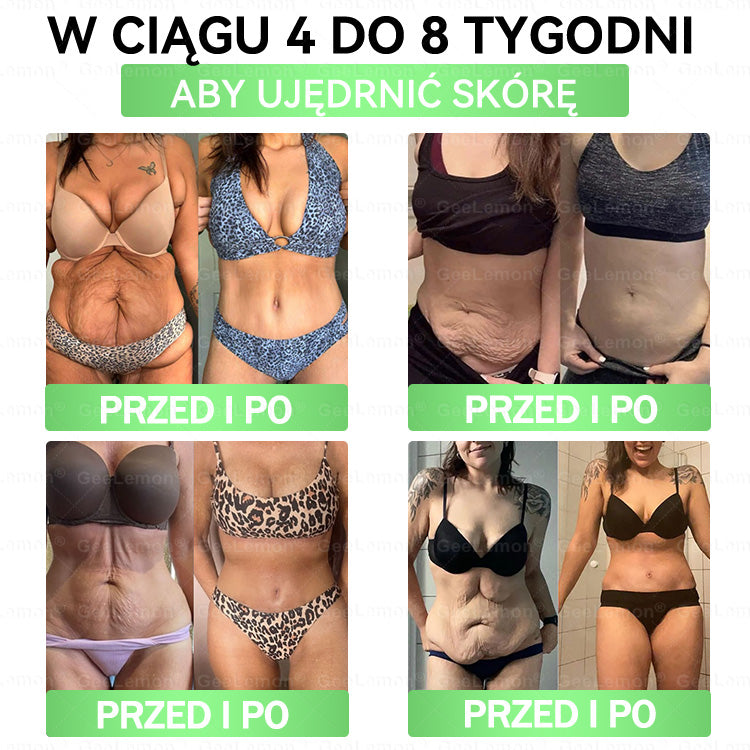 🔥🔥 𝐆𝐞𝑒𝐿𝑒𝐦𝐨𝐧® 𝐆𝐥𝐮𝐦ase𝐭𝐢𝐝𝐞 𝟖 𝐰 𝟏 Smukły i Zdrowy Nano Plaster z Mikronakłuciami 🇵🇱(Tylko raz dziennie, widoczne zmiany już w 7 dni)✅ Na otyłość, 🅛🅞🅞🅢🅔 🅢🅚🅘🅝 wiotką skórę, cukrzycę, bezdech senny, problemy ze stawami i wiele więcej 5