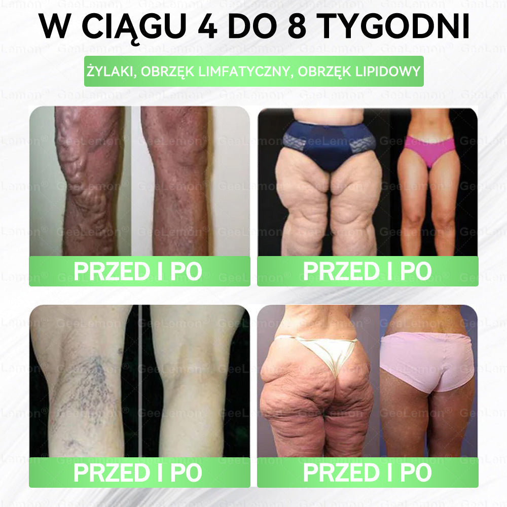 🔥🔥 𝐆𝐞𝑒𝐿𝑒𝐦𝐨𝐧® 𝐆𝐥𝐮𝐦ase𝐭𝐢𝐝𝐞 𝟖 𝐰 𝟏 Smukły i Zdrowy Nano Plaster z Mikronakłuciami 🇵🇱(Tylko raz dziennie, widoczne zmiany już w 7 dni)✅ Na otyłość, 🅛🅞🅞🅢🅔 🅢🅚🅘🅝 wiotką skórę, cukrzycę, bezdech senny, problemy ze stawami i wiele więcej 5